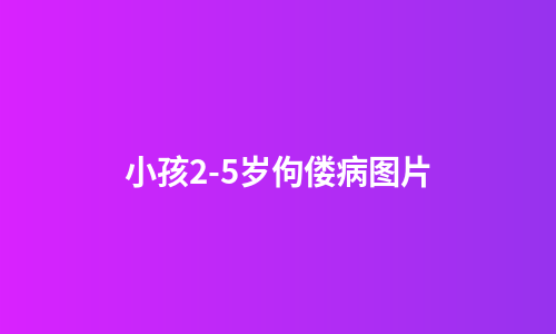 小孩2-5岁佝偻病图片