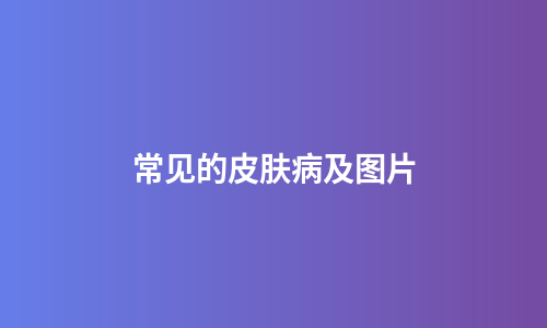 常见的皮肤病及图片