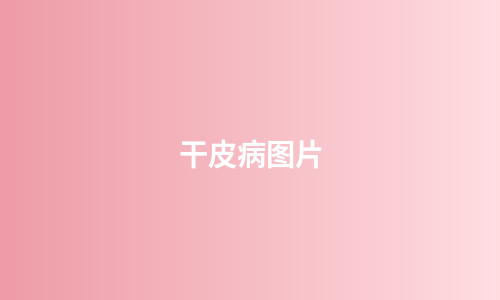 干皮病图片
