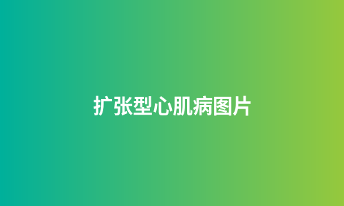 扩张型心肌病图片