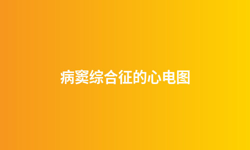 病窦综合征的心电图
