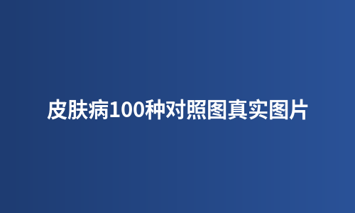 皮肤病100种对照图真实图片