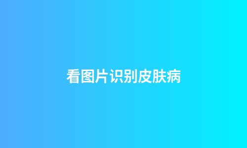 看图片识别皮肤病