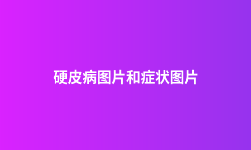 硬皮病图片和症状图片