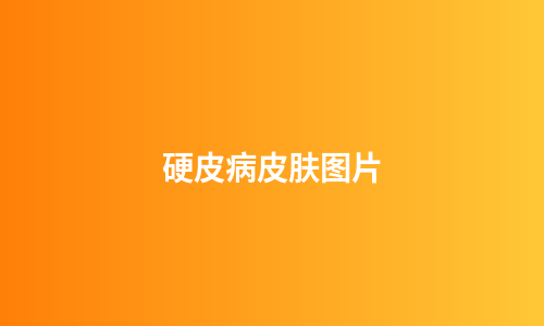 硬皮病皮肤图片