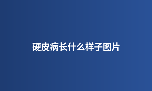 硬皮病长什么样子图片