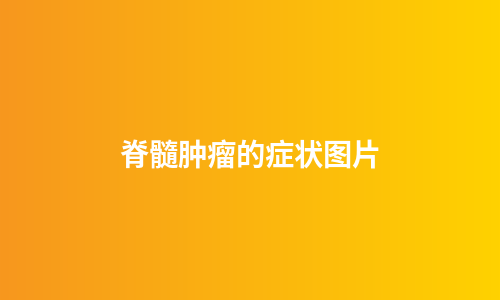 脊髓肿瘤的症状图片