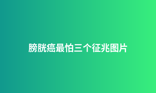 膀胱癌最怕三个征兆图片