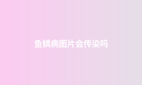 鱼鳞病图片会传染吗