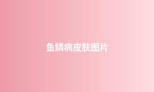鱼鳞病皮肤图片