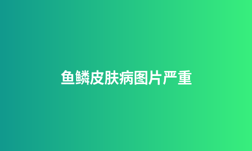鱼鳞皮肤病图片严重