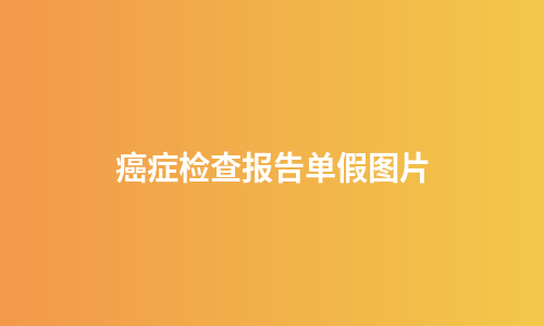 癌症检查报告单假图片