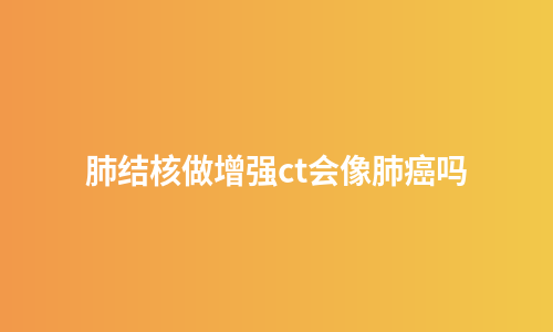 肺结核做增强ct会像肺癌吗